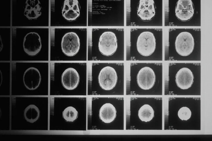 Microsoft's Artificial Intelligence Outperformed Doctors in Diagnosing Complex Diseases