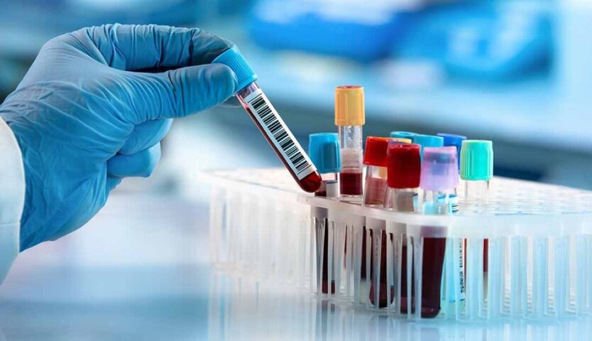 HIV, wirusy zapalenia wątroby i gruźlica można kontrolować: Ukraińców zachęca się do bezpłatnego testowania
